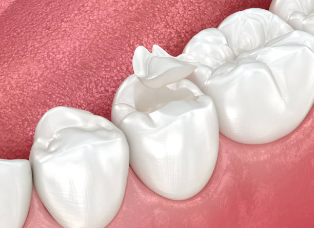 Oral Surgery in Merryville, LA